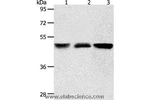 Western blot analysis of Human brain malignant glioma and human fetal kidney tissue, A172 cell, using ACOT9 Polyclonal Antibody at dilution of 1:600