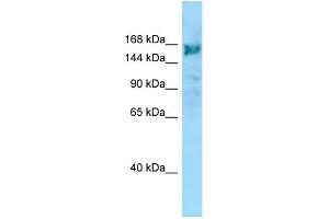 WB Suggested Anti-ARHGEF10 Antibody Titration: 1. (ARHGEF10 Antikörper  (C-Term))
