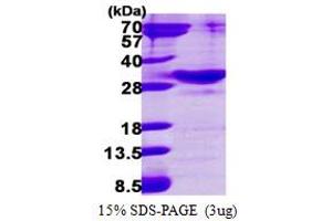 SDS-PAGE (SDS) image for RAB34, Member RAS Oncogene Family (RAB34) (AA 1-259) protein (His tag) (ABIN667981) (RAB34 Protein (AA 1-259) (His tag))