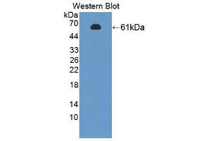 Western blot analysis of the recombinant protein. (PTBP1 Antikörper  (AA 1-531))