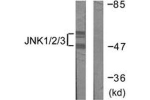 Western blot analysis of extracts from 293 cells, treated with UV 5', using JNK1/2/3 (Ab-183/185) Antibody. (JNK Antikörper  (AA 151-200))