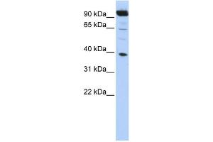 WB Suggested Anti-HOXB2 Antibody Titration:  0. (HOXB2 Antikörper  (N-Term))