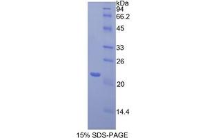 SDS-PAGE analysis of Mouse Toll Like Receptor 3 Protein. (TLR3 Protein)