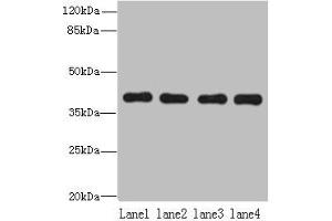 Western blot All lanes: NUDT9 antibody at 8 μg/mL Lane 1: Raji whole cell lysate Lane 2: Jurkat whole cell lysate Lane 3: Mouse kidney tissue Lane 4: Hela whole cell lysate Secondary Goat polyclonal to rabbit IgG at 1/10000 dilution Predicted band size: 40, 34 kDa Observed band size: 40 kDa (NUDT9 Antikörper  (AA 47-350))