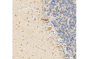 anti-Dynamin 1-Like (DNM1L) (AA 618-736) antibody