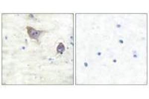 Immunohistochemical analysis of paraffin-embedded human brain tissue using Synuclein β antibody.
