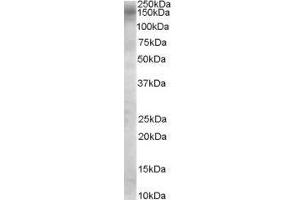 Image no. 2 for anti-TBC1 Domain Family, Member 4 (TBC1D4) (Internal Region) antibody (ABIN374867) (TBC1D4 Antikörper  (Internal Region))