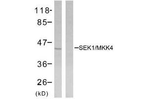 Western blot analysis of extracts from NIH/3T3 cells using SEK1/MKK4 (Ab-80) antibody (E021132). (MAP2K4 Antikörper)