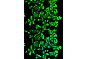 Immunofluorescence analysis of U2OS cells using HSP90AB1 antibody. (HSP90AB1 Antikörper)