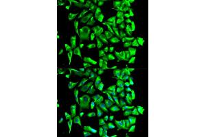 Immunofluorescence analysis of U2OS cells using HSP90AB1 antibody.