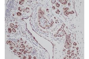 Immunohistochemistry (IHC) image for anti-Fibroblast Growth Factor 2 (Basic) (FGF2) antibody (Biotin) (ABIN2473614) (FGF2 Antikörper  (Biotin))