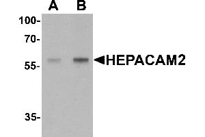 Western Blotting (WB) image for anti-HEPACAM Family Member 2 (HEPACAM2) (C-Term) antibody (ABIN1077405) (HEPACAM2 Antikörper  (C-Term))