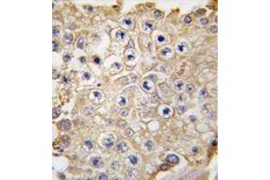 Formalin-fixed and paraffin-embedded human testis tissue reacted with APPBP1 antibody (C-term) , which was peroxidase-conjugated to the secondary antibody, followed by DAB staining. (NAE1 Antikörper  (C-Term))