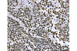 IHC analysis of THAP11 using anti-THAP11 antibody (ABIN7599230). (THAP11 Antikörper  (AA 1-294))