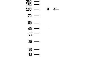 anti-Inter-alpha Trypsin Inhibitor, Heavy Chain 1 (ITIH1) (Internal Region) antibody