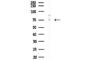 anti-Forkhead Box K2 (FOXK2) (C-Term) antibody