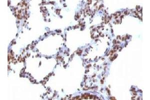 IHC testing of FFPE rat lung with Nuclear Antigen antibody.