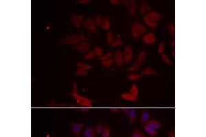 Immunofluorescence analysis of MCF-7 cells using RPL11 Polyclonal Antibody