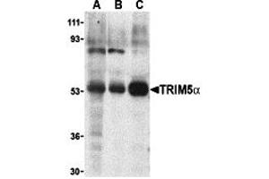 Western Blotting (WB) image for anti-Tripartite Motif Containing 5 (TRIM5) (Middle Region 2) antibody (ABIN1031206) (TRIM5 Antikörper  (Middle Region 2))