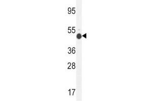 Western Blotting (WB) image for anti-Glucosaminyl (N-Acetyl) Transferase 2, I-Branching Enzyme (I Blood Group) (GCNT2) (AA 364-391) antibody (ABIN3031054)