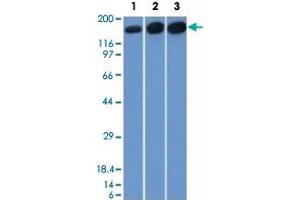 Western Blot analysis of Lane 1: HepG2, Lane 2: HeLa and Lane 3: 3T3 cell lysates with TOP2A monoclonal antibody, clone TOP2A/1361 . (Topoisomerase II alpha Antikörper  (AA 1352-1493))