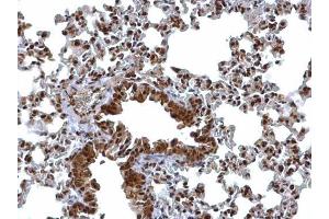 IHC-P Image BCL7A antibody [C2C3], C-term detects BCL7A protein at nucleus on mouse lung by immunohistochemical analysis. (BCL7A Antikörper  (C-Term))