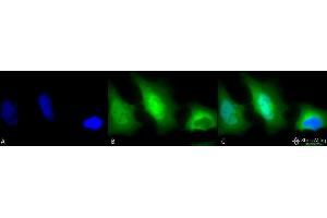 Immunocytochemistry/Immunofluorescence analysis using Rabbit Anti-SOD (Cu/Zn) Polyclonal Antibody . (SOD1 Antikörper  (FITC))