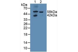 Figure. (GALNS Antikörper  (AA 172-381))