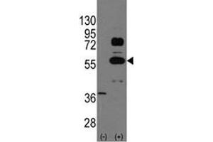 Western blot analysis of SOX9 antibody and 293 cell lysate (2 ug/lane) either nontransfected (Lane 1) or transiently transfected with the SOX9 gene (2). (SOX9 Antikörper  (AA 41-70))