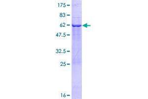 TBC1D7 Protein (AA 1-293) (GST tag)