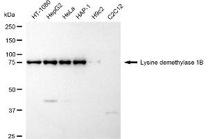 Western blotting analysis using Lysine demethylase 1B antibody (ABIN7799298). (Rekombinanter KDM1B Antikörper)