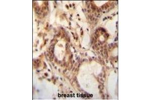 NUDT15 antibody (C-term) (ABIN654983 and ABIN2844623) immunohistochemistry analysis in formalin fixed and paraffin embedded human breast tissue followed by peroxidase conjugation of the secondary antibody and DAB staining.