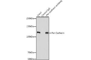 Immunoprecipitation analysis of 900 μg extracts of PC-3 cells using 3 μg Pan Cadherin antibody (ABIN7266233). (CDH1,CDH2,CDH3,CDH4 (AA 800-882) Antikörper)