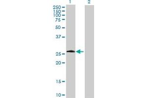 Western Blot analysis of PSPH expression in transfected 293T cell line by PSPH MaxPab polyclonal antibody. (PSPH Antikörper  (AA 1-225))
