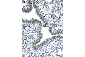Immunohistochemical staining (Formalin-fixed paraffin-embedded sections) of human lung (A, B) with CCRN4L polyclonal antibody  at 4-8 ug/mL working concentration. (CCRN4L Antikörper  (N-Term))