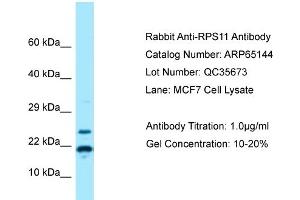 Western Blotting (WB) image for anti-Ribosomal Protein S11 (RPS11) (N-Term) antibody (ABIN2790057) (RPS11 Antikörper  (N-Term))