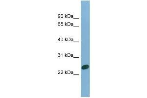 WB Suggested Anti-CHMP1B Antibody Titration: 0. (CHMP1B Antikörper  (N-Term))