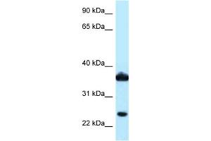 WB Suggested Anti-AKR1C3 Antibody Titration: 1. (AKR1C3 Antikörper  (N-Term))