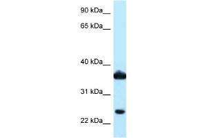WB Suggested Anti-AKR1C3 Antibody Titration: 1.