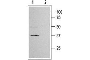 Western blot analysis of rat pancreas membranes: - 1. (KCNJ11 Antikörper  (C-Term, Intracellular))