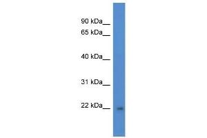 Western Blot showing DGCR6L antibody used at a concentration of 1 ug/ml against Fetal Brain Lysate (DGCR6L Antikörper  (C-Term))