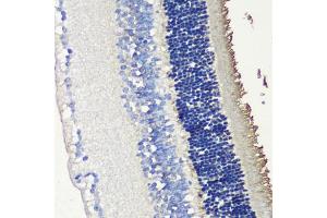 Immunohistochemistry of paraffin-embedded mouse retina using SAG antibody (ABIN6132558, ABIN6147361, ABIN6147362 and ABIN6216887) at dilution of 1:200 (40x lens). (SAG Antikörper  (AA 1-405))