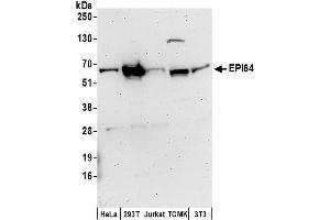 anti-TBC1 Domain Family, Member 10A (TBC1D10A) (AA 458-508) antibody