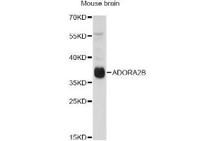Western blot analysis of extracts of mouse brain, using ADORA2B antibody (ABIN6294005) at 1:1000 dilution. (Adenosine A2b Receptor Antikörper)
