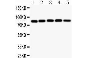 Observed bind size: 85KD (IKK alpha Antikörper  (AA 411-745))