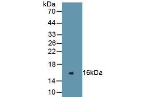 Detection of Recombinant REN, Human using Monoclonal Antibody to Renin (REN) (Renin Antikörper  (AA 67-153))