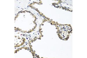 Immunohistochemistry of paraffin-embedded human prostate using ARSF antibody at dilution of 1:100 (40x lens).