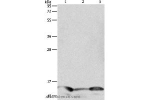 Western blot analysis of Human seminoma tissue, hela and A549 cell, using PFN1 Polyclonal Antibody at dilution of 1:1000 (PFN1 Antikörper)