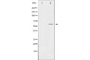 Western blot analysis of Smad2 expression in HepG2 whole cell lysates,The lane on the left is treated with the antigen-specific peptide. (SMAD2 Antikörper  (C-Term))