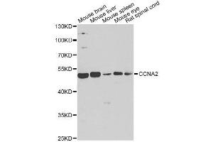 Western blot analysis of extracts of various cell lines, using CCNA2 antibody. (Cyclin A Antikörper)